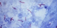 Sindicato anuncia quatro novos casos de tuberculose latente no Hospital de Portimão