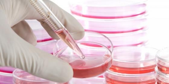 Proteína pode desempenhar papel-chave na doença de Parkinson