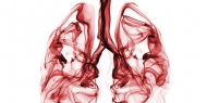 Pneumonia é a doença pulmonar que mais mata em Portugal