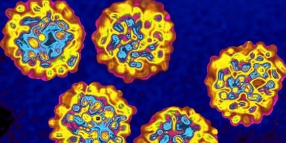 Nova terapêutica da hepatite C curou 2.050 doentes, 9.100 estão em tratamento